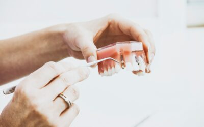 Infiammazione impianto dentale: Sintomi, diagnosi e cura